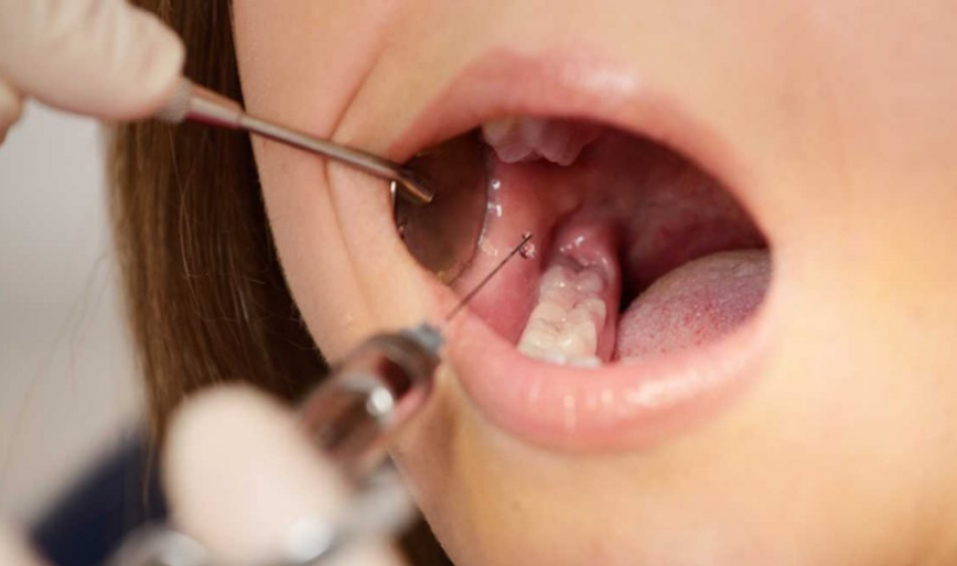 Dental Tedavilerde Anestezinin Önemi Nedir?