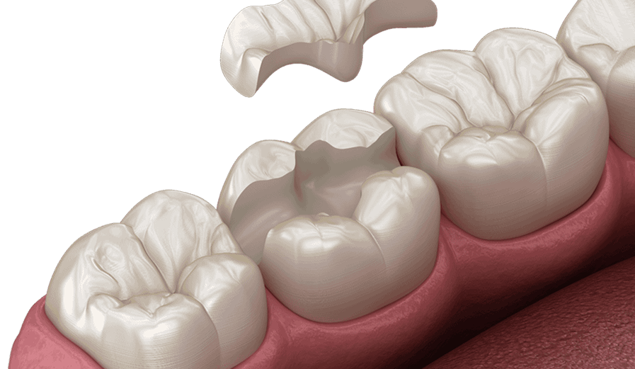 Biomimetic Dentistry