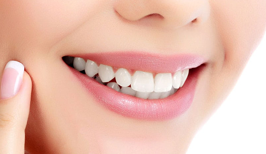 Smile Design