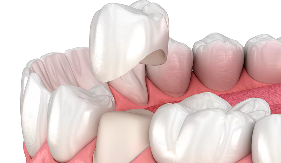 Restorative Dentistry